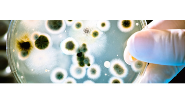 promieniowanie ultrafioletowe w lampach bakteriobójczych